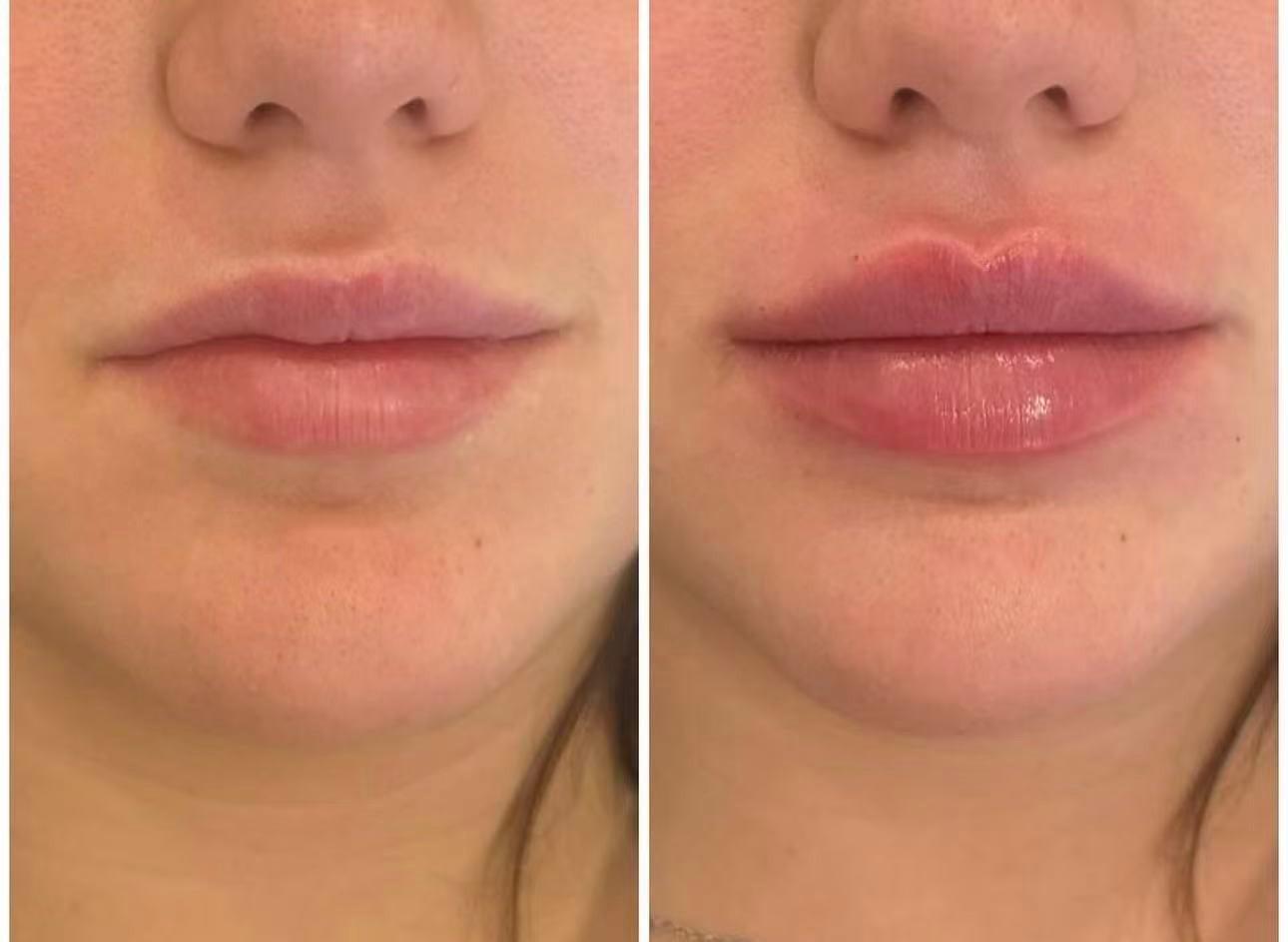 Before and after case 1