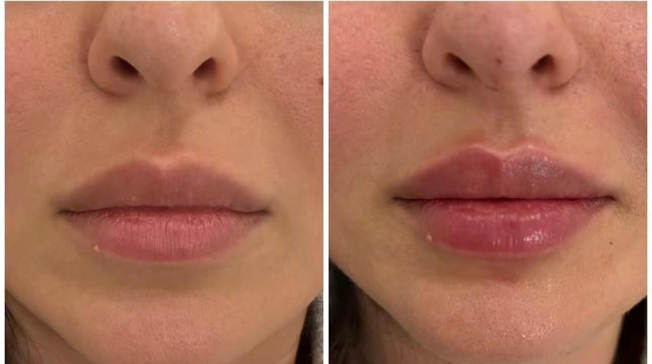 Before and after case 2 with measurements