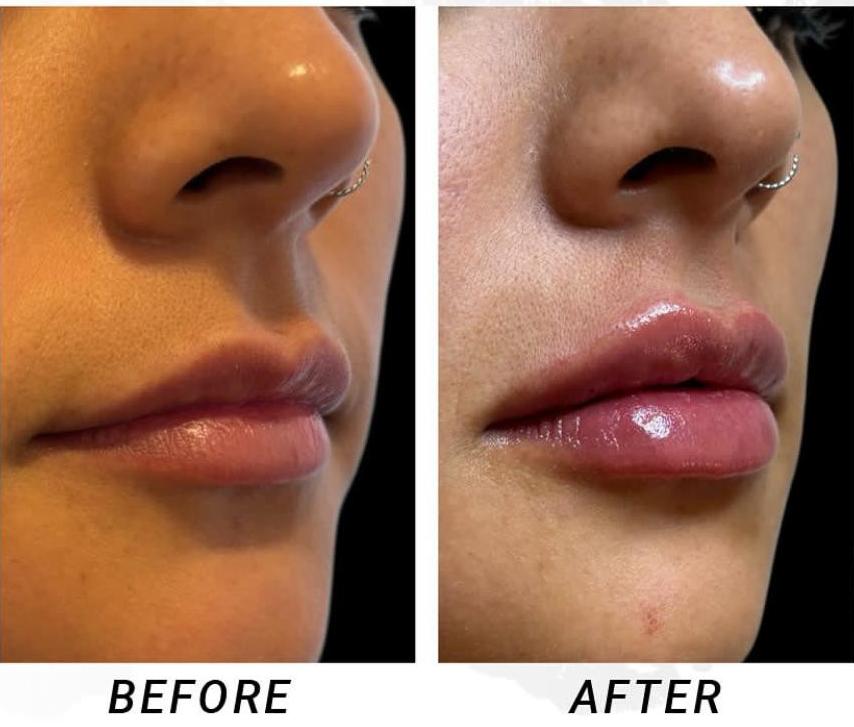 Before and after case 4